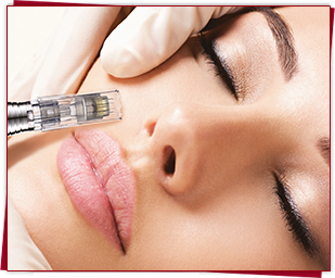 Micro - Needling